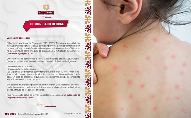 Suspenden “Carnaval Coyotepec 2026”, ante riesgos de contagio por sarampión